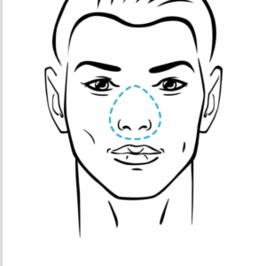 Nasal Masks